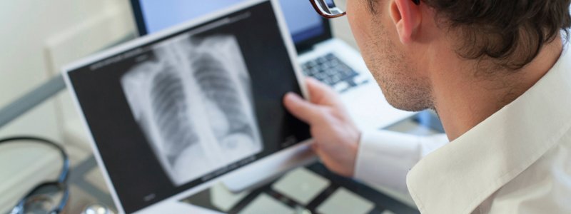 Лечение рака легких в ведущих центрах и клиниках Германии